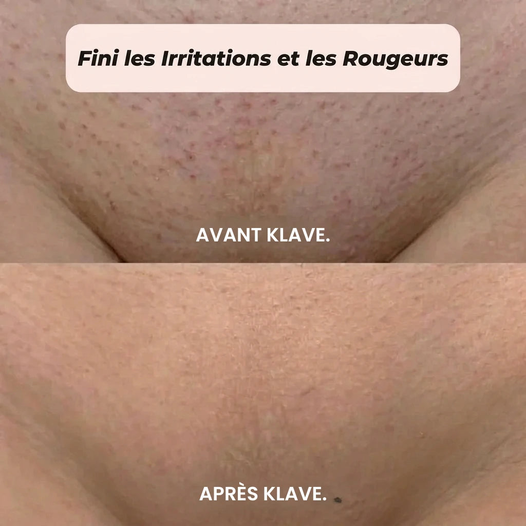 RASOIR 2 EN 1 MAILLOT & CORPS KLAVE™