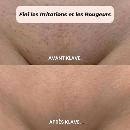RASOIR 2 EN 1 MAILLOT & CORPS KLAVE™
