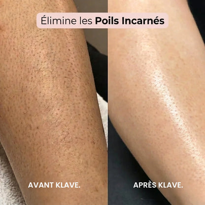 RASOIR 2 EN 1 MAILLOT & CORPS KLAVE™